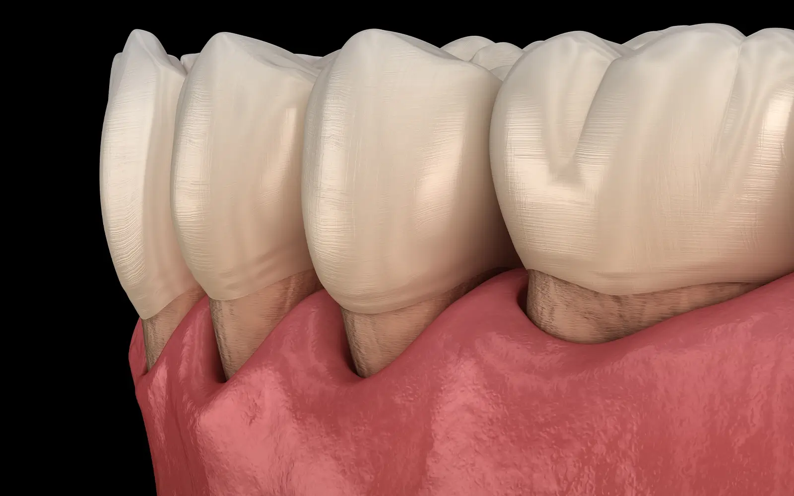 歯周病(periodontal pathology)