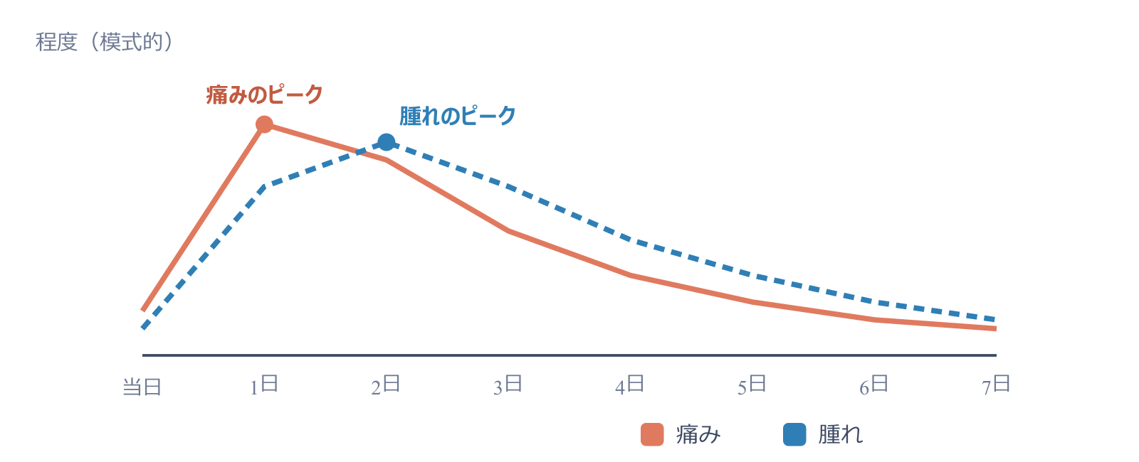 術後の痛みと腫れの経過。痛みは1日目ごろ、腫れは2日目ごろがピークで、1週間ほどで落ち着く。