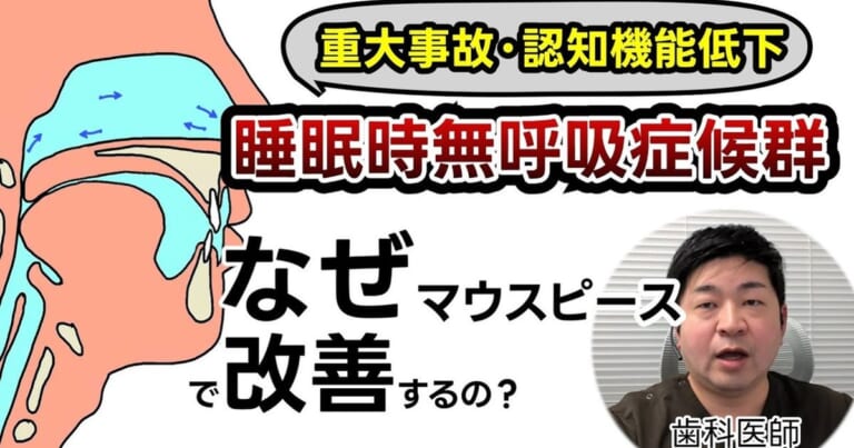 睡眠時無呼吸症候群、歯科のマウスピースで本当に良くなる？